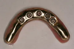 Implant not in mouth