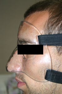 Custom Face Shield